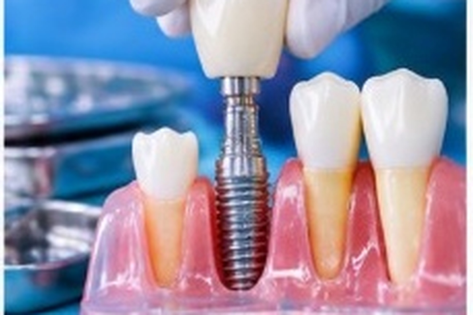 Cosmetic Dentistry