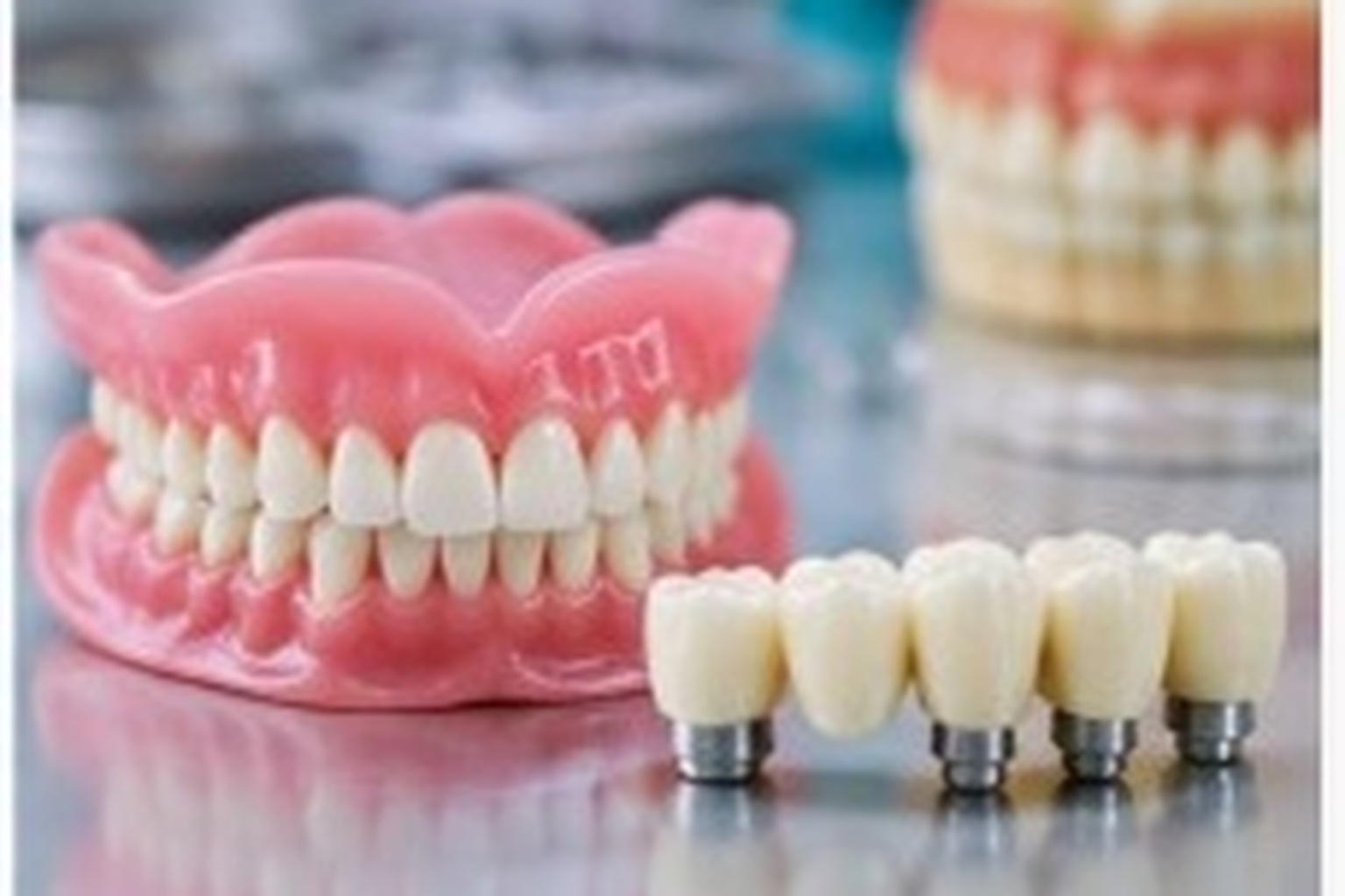 Extractions