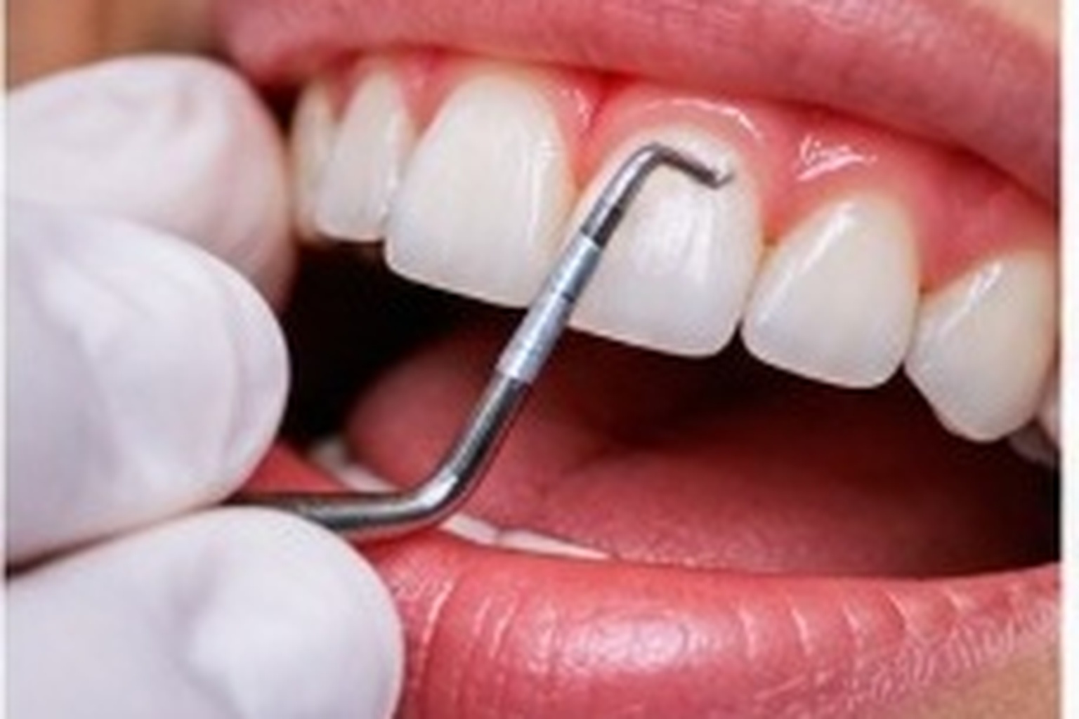 Dentures & Bridges