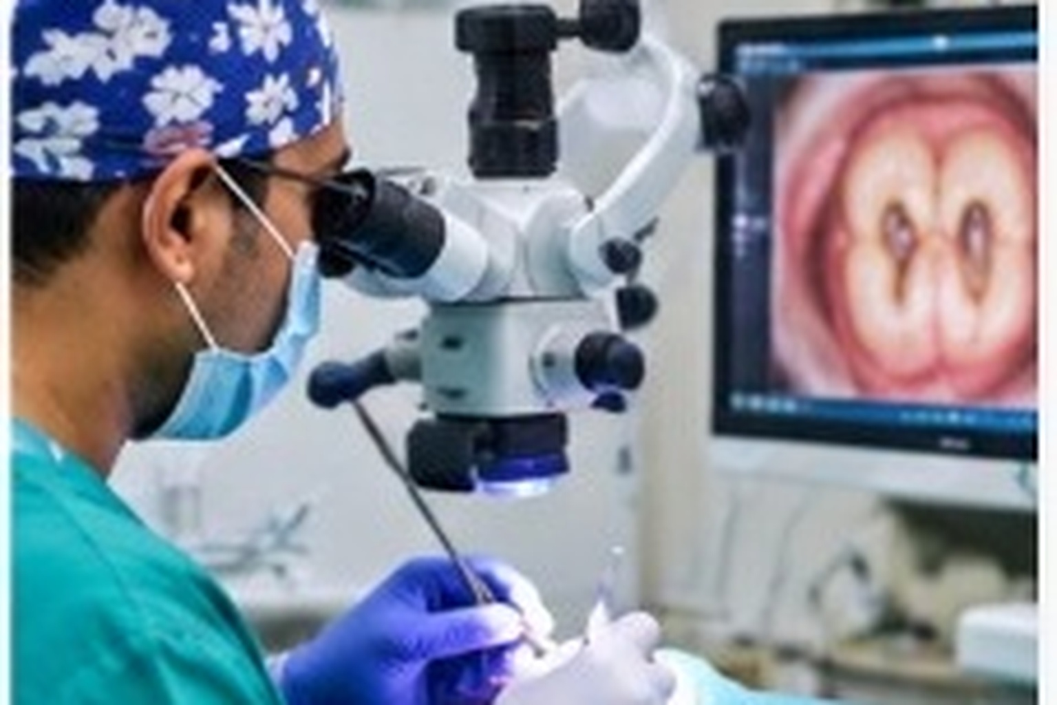 Root Canal Treatment